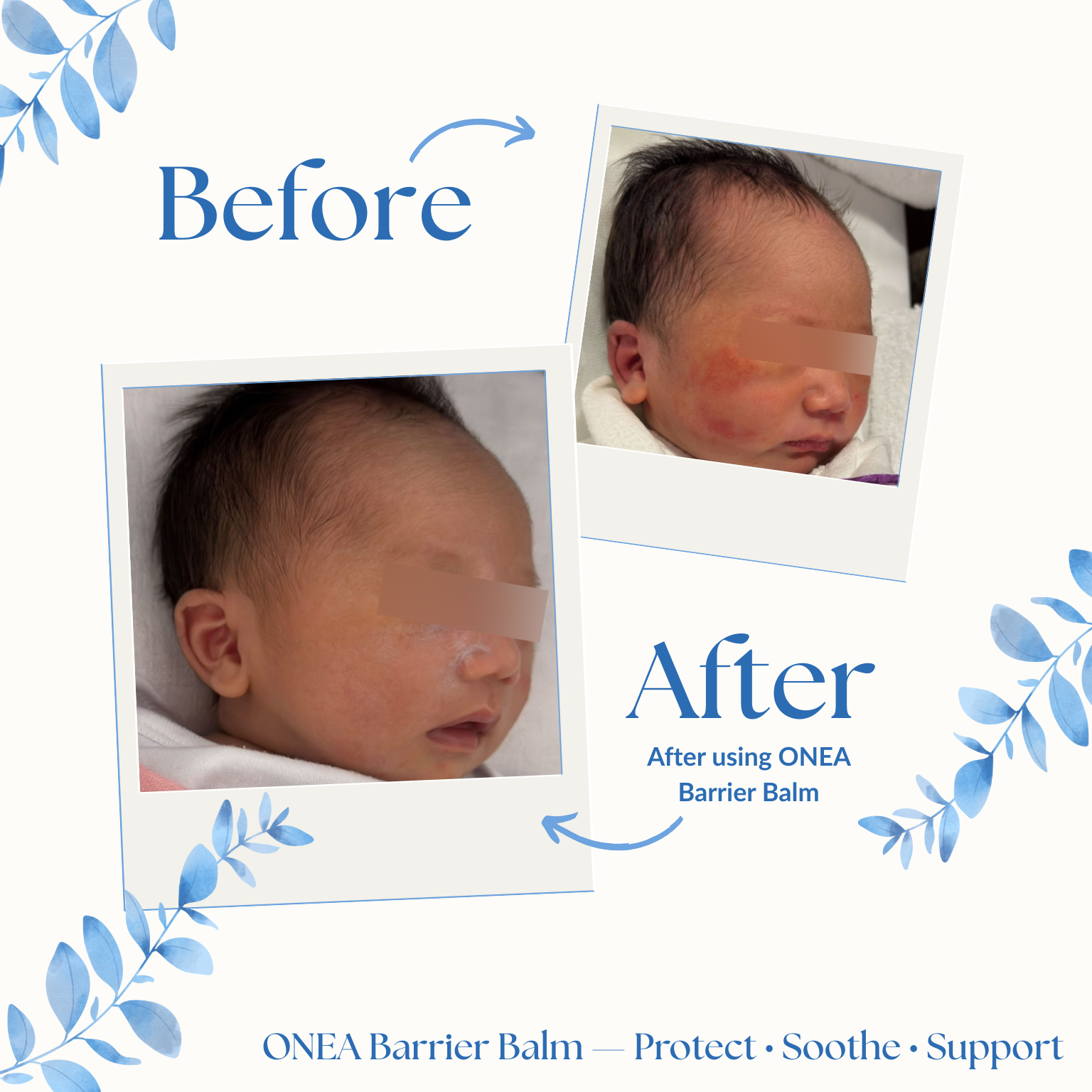 Complete Eczema-Prone Skin Care