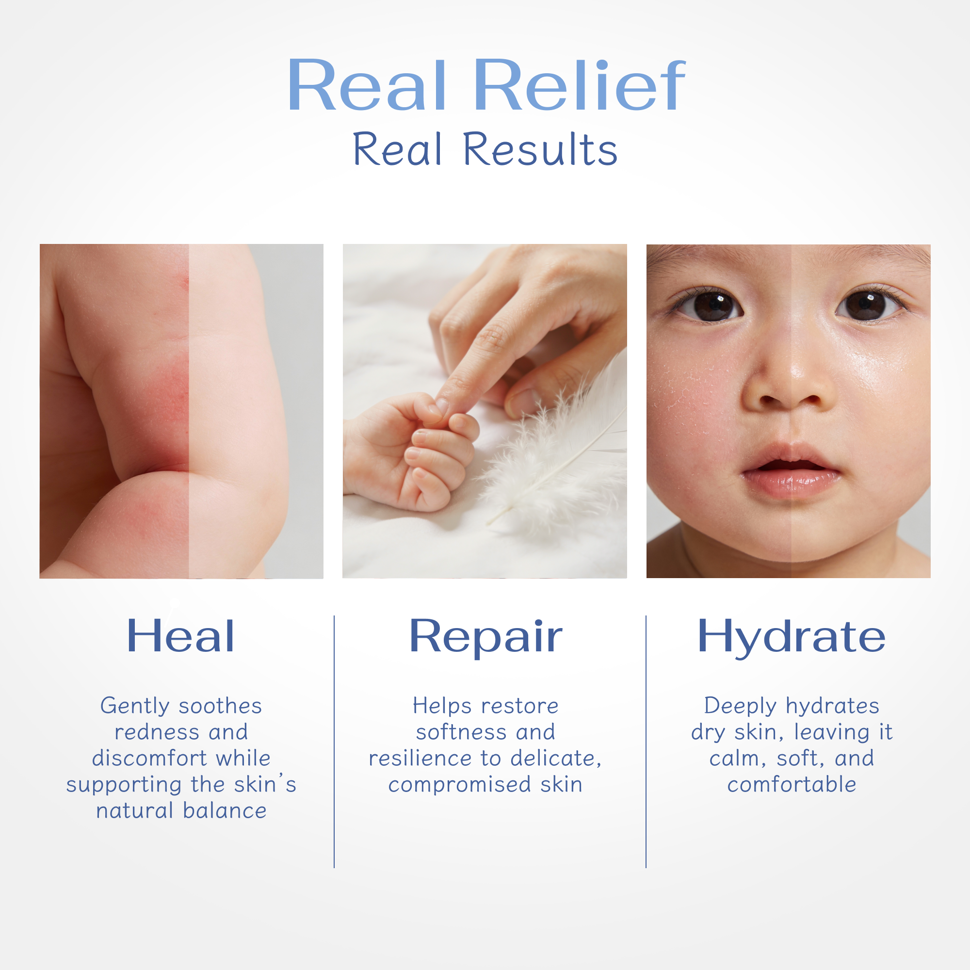 Complete Eczema-Prone Skin Care